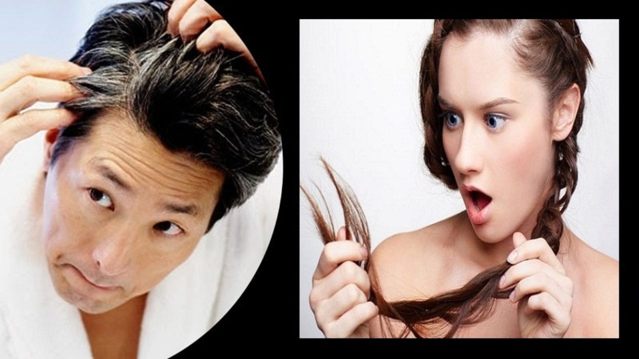 Foods Items To Prevent White Hair